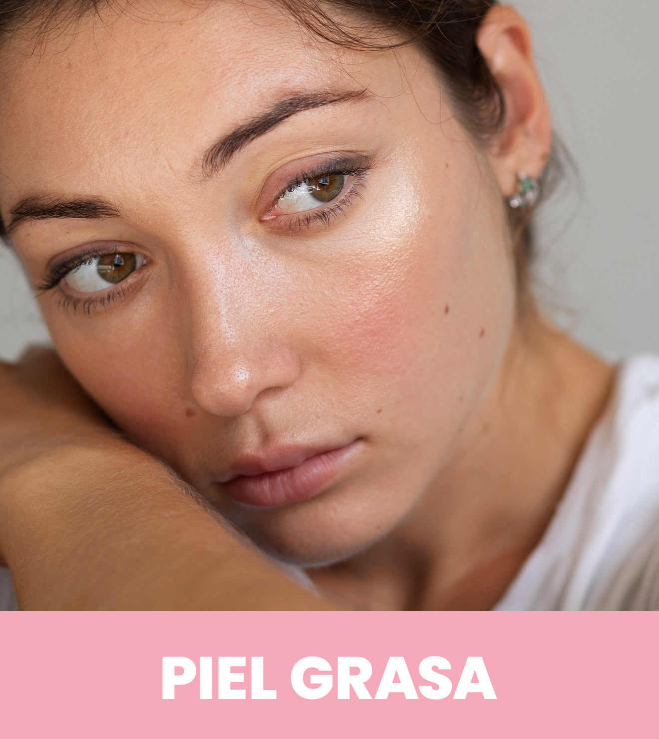 Piel Grasa