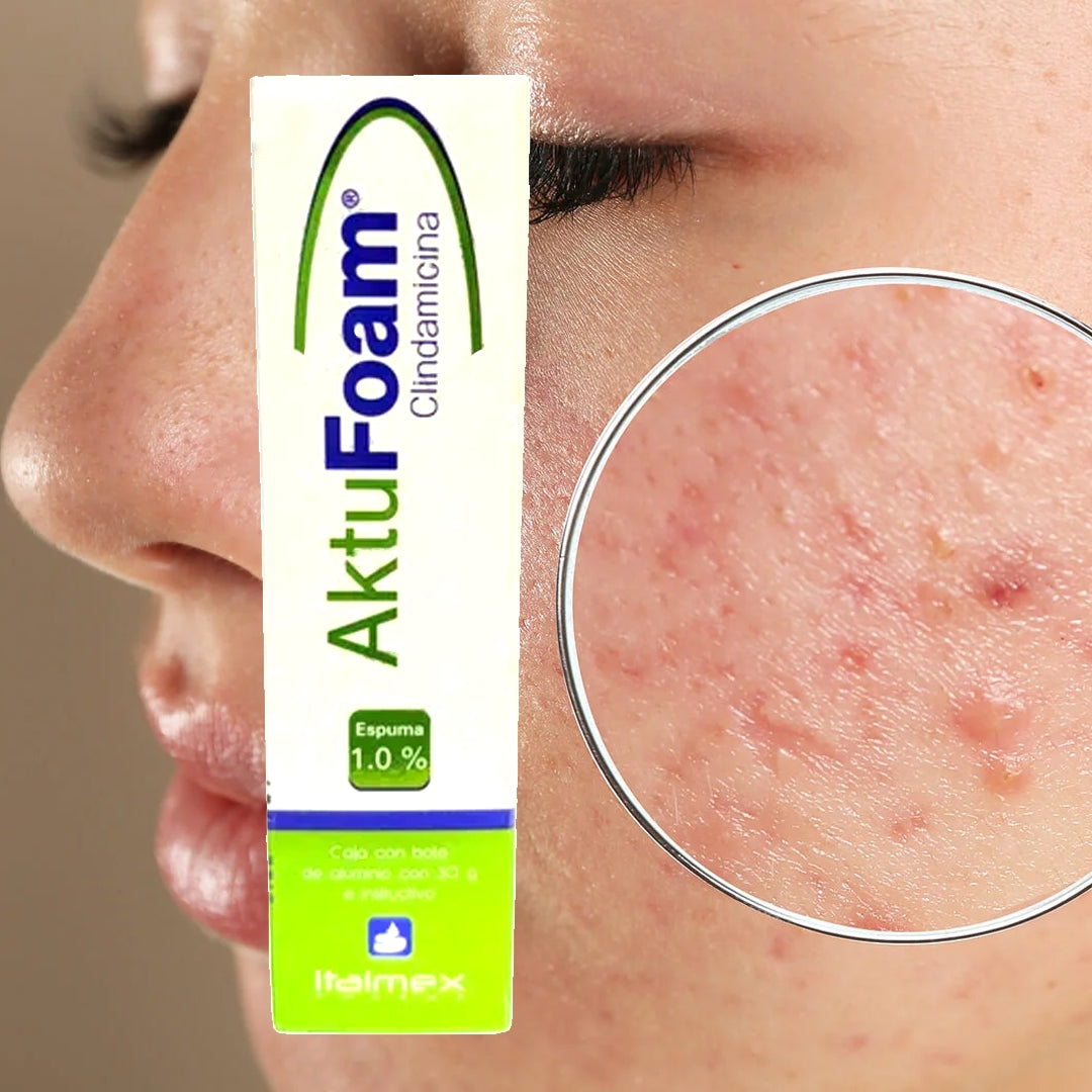 AKTUFOAM CLINDAMIN 1.0% – ESPUMA ANTIACNÉ (30 g)