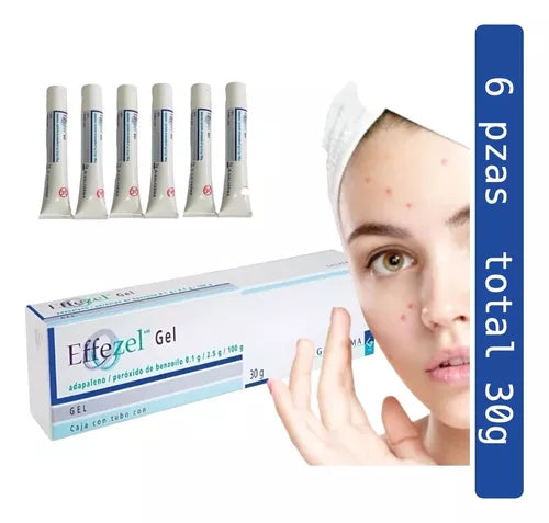Effezel 0.1% Total 30gr Kit 6 Cremas De 5gr Anti Acné