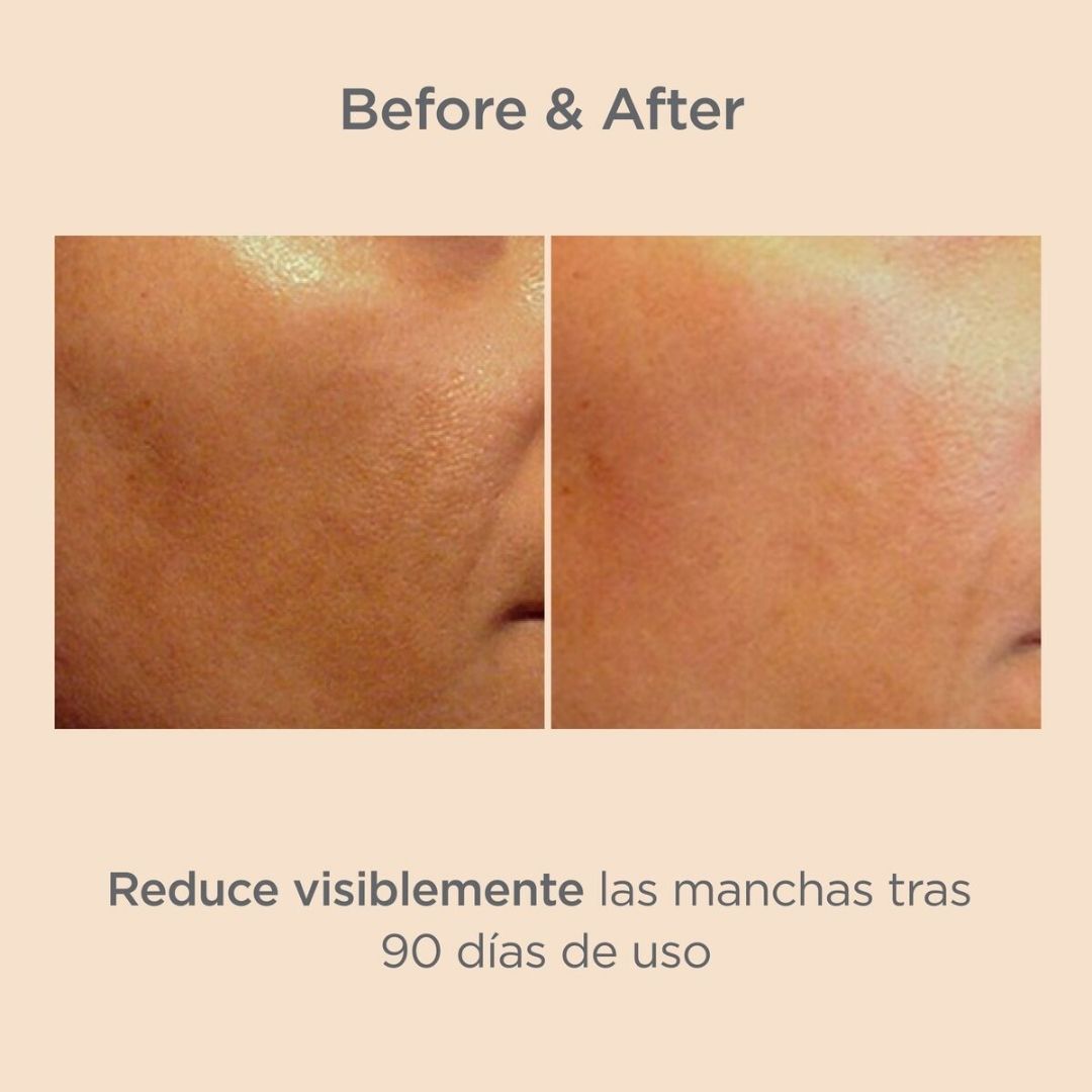 ISDIN Melaclear Serum Unificador de Tono (15 ml)