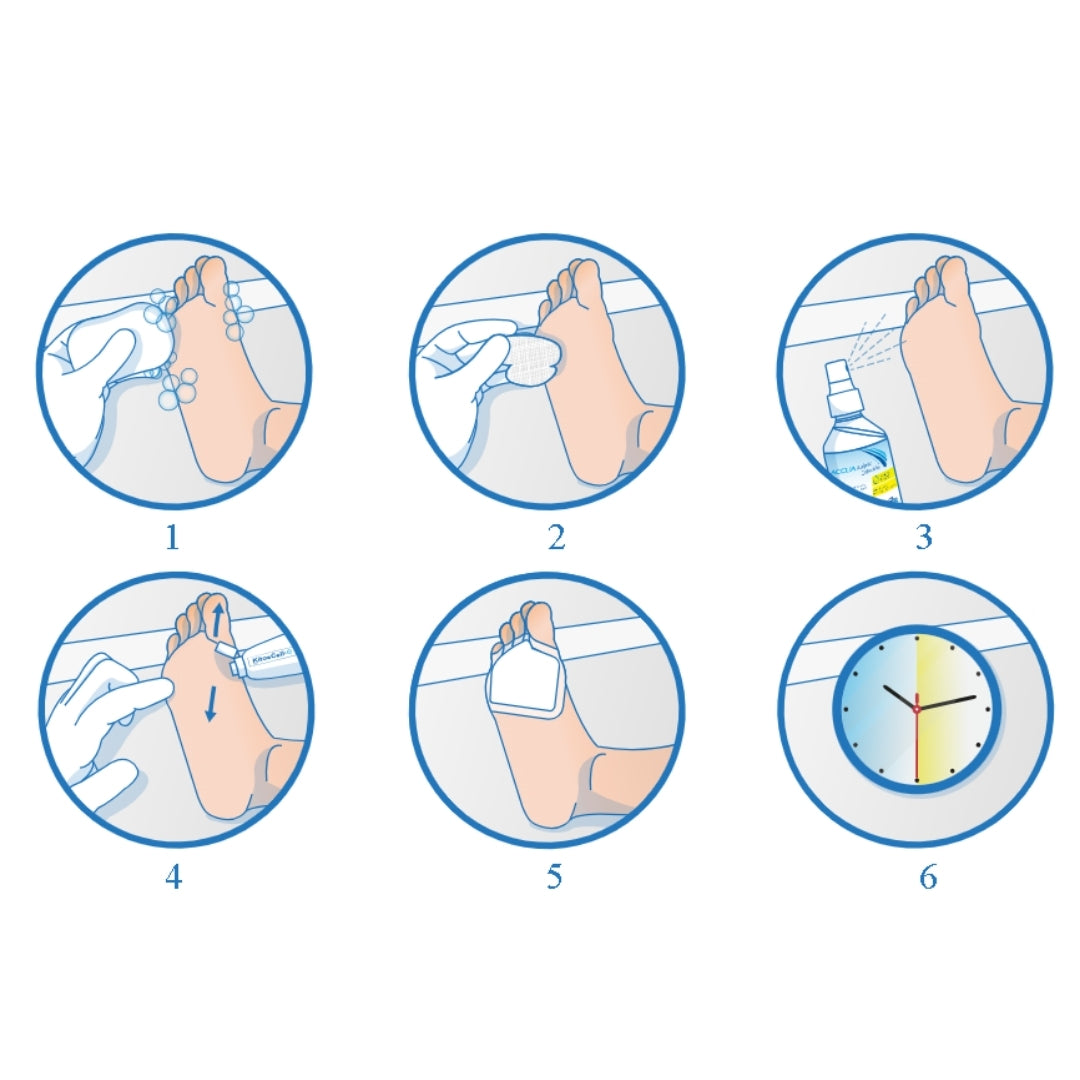 Kitoscell Q Gel 120 G