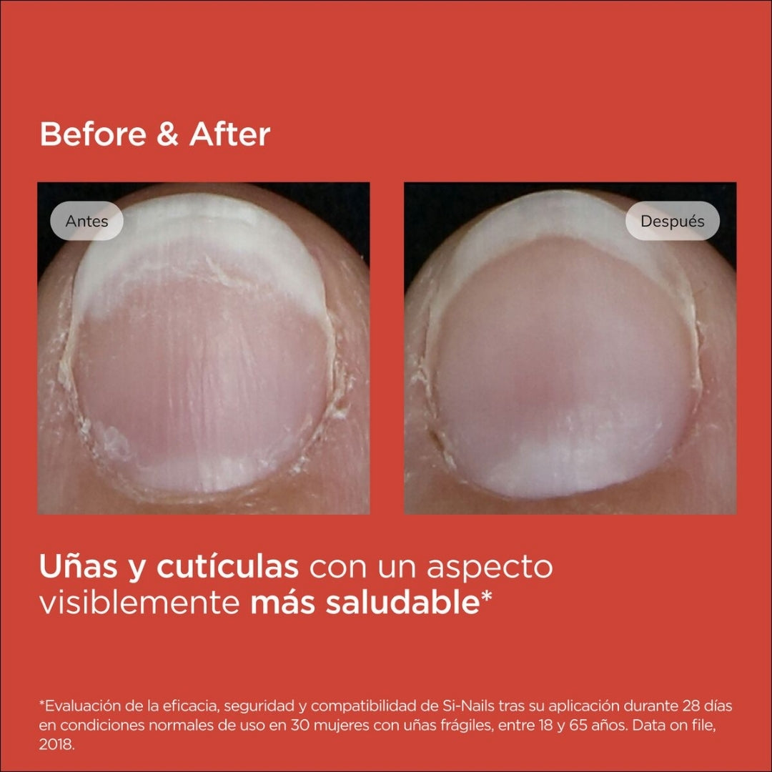 Isdin Si-nails Fortalecedor De Uñas (2,5 ml)