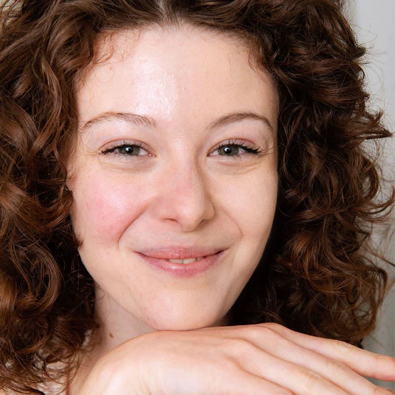 SVR Sensifine Cuidado Antirojeces (40 ml)