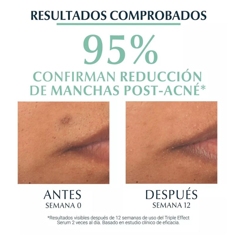 Eucerin Serum Dermopure Oil Control (40 ml)