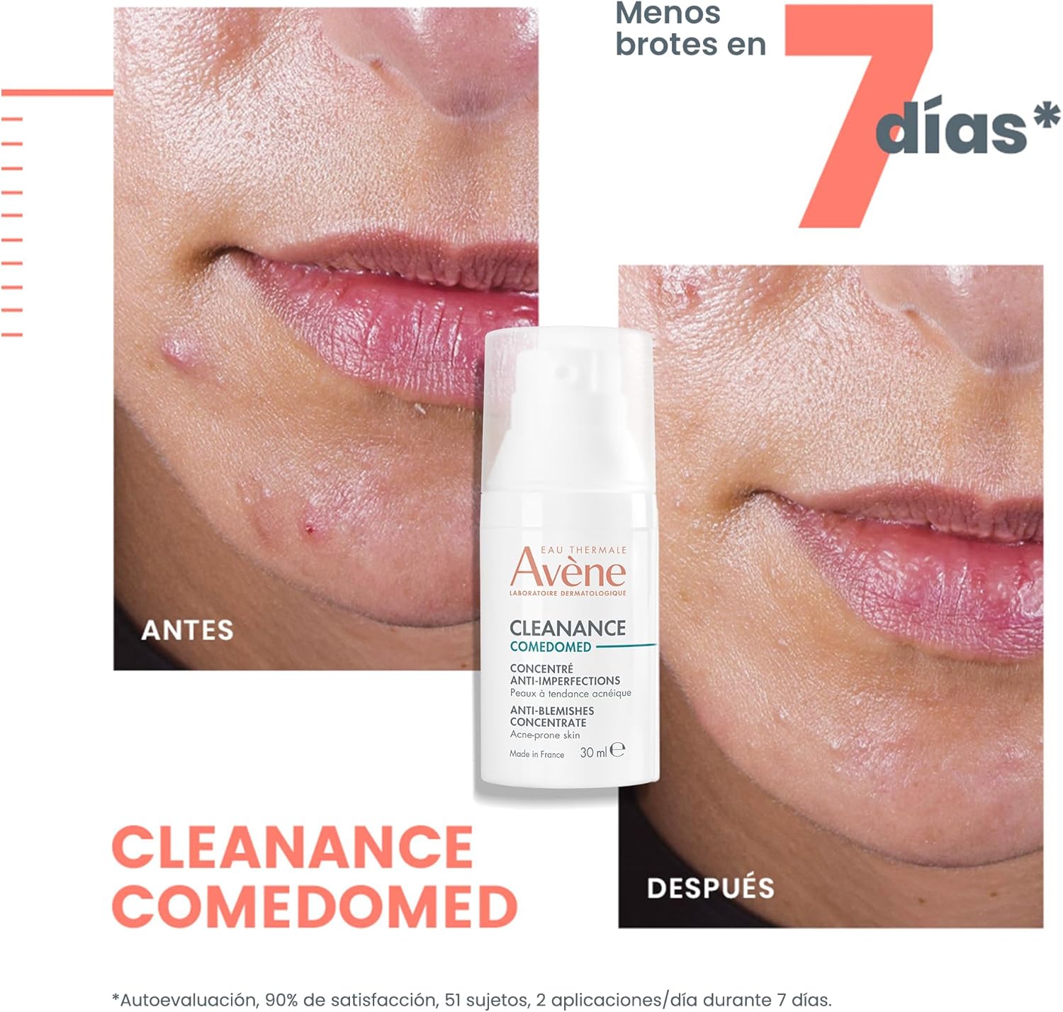 Avène Cleanance Comedomed Concentrado Anti-imperfecciones 30 ml
