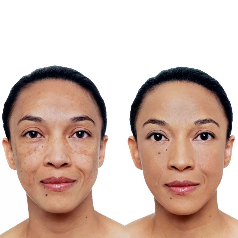 Vichy DERMABLEND (30 ml.)