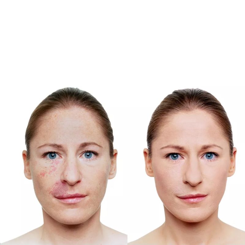 Vichy DERMABLEND (30 ml.)