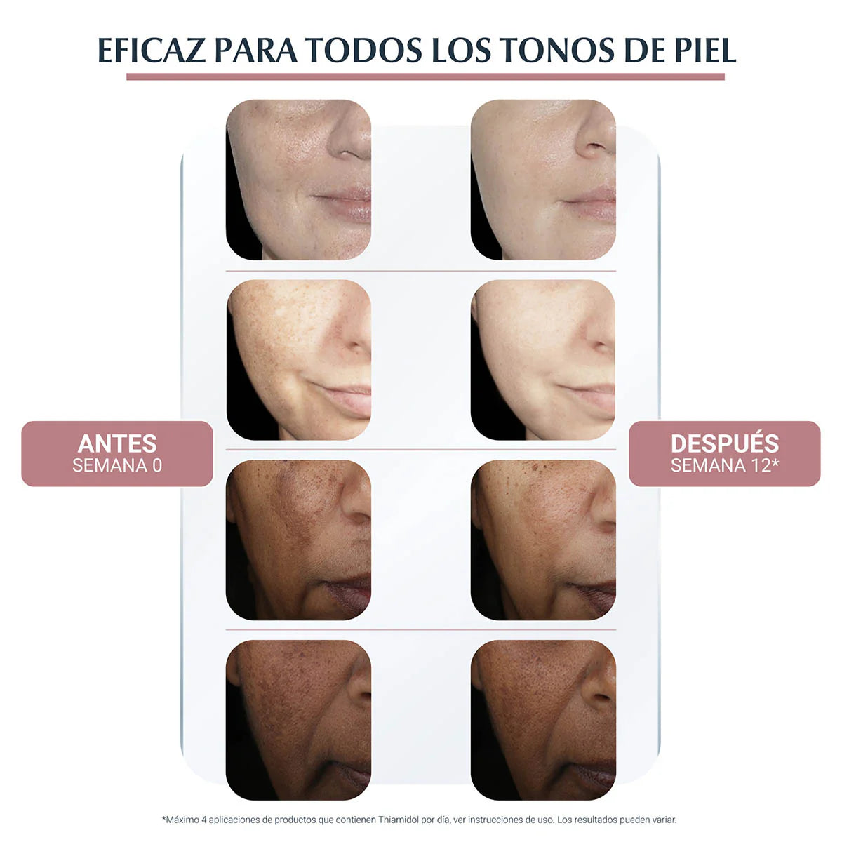 Eucerin Anti-Pigment Dual Sérum Facial Anti Manchas (30 ml)